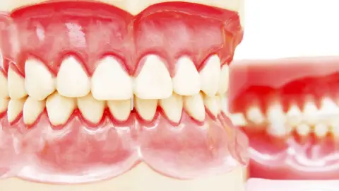 Prótesis Dentales