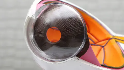 Optica y Audiometria