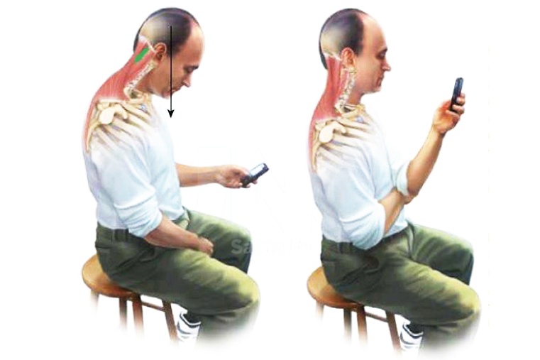 Problemas cervicales y de columna por el uso del celular imagen 1 Problemas cervicales y de columna por el uso del celular imagen 1